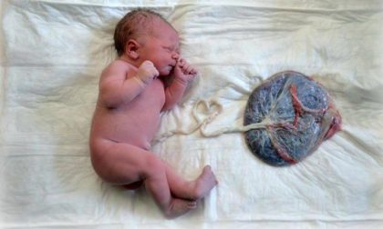 Lotus Birth