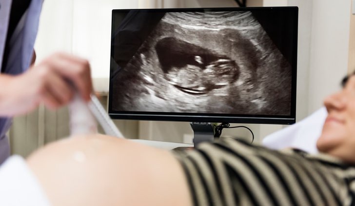 A cosa serve l'ecografia morfologica e quando va fatta